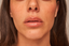 Masseter